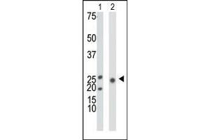 The anti-KHK Pab is used in Western blot to detect KHK in mouse liver tissue lysate (Lane 1) and 293 cell lysate (Lane 2). (Ketohexokinase antibody  (N-Term))