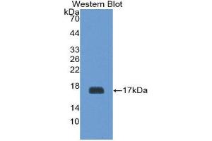 Western Blotting (WB) image for anti-Glycoprotein Ib (Platelet), beta Polypeptide (GP1BB) (AA 53-176) antibody (ABIN1868212) (GP1BB antibody  (AA 53-176))