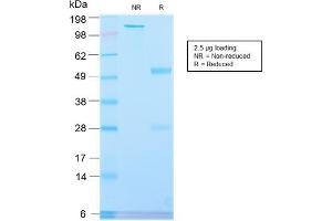SDS-PAGE Analysis Purified PLAP Rabbit Recombinant Monoclonal Antibody (ALPP/2899R). (Recombinant PLAP antibody)
