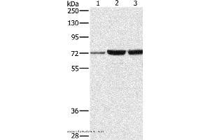 Western blot analysis of A375, 231 and hela cell, using DOK1 Polyclonal Antibody at dilution of 1:750 (DOK1 antibody)