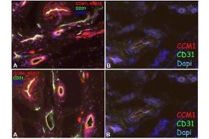 Immunofluorescence staining of Human foreskin (Cryo-section of unfixed tissue) with anti-CCM1 Antibody Cat. (KRIT1 antibody  (N-Term))