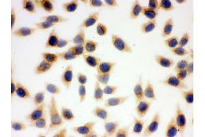 IHC analysis of SOD2  using anti-SOD2  antibody . (SOD2 antibody  (C-Term))