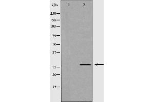 Western blot analysis of HT29 cell lysate, using CEACAM3 Antibody. (CEACAM3 antibody  (Internal Region))