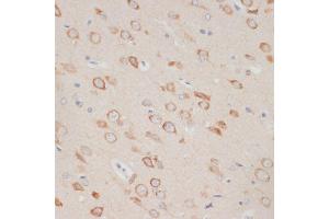 Immunohistochemistry of paraffin-embedded rat brain using  antibody (ABIN6129209, ABIN6137382, ABIN6137383 and ABIN6219595) at dilution of 1:100 (40x lens). (AXIN2 antibody  (AA 650-750))