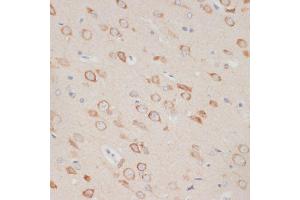 Immunohistochemistry of paraffin-embedded rat brain using  antibody (ABIN6129209, ABIN6137382, ABIN6137383 and ABIN6219595) at dilution of 1:100 (40x lens).