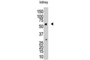 The RBCK1 polyclonal antibody  is used in Western blot to detect RBCK1 in mouse kidney tissue lysate. (RBCK1 antibody  (N-Term))