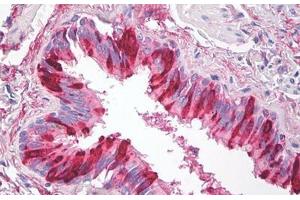Image no. 1 for anti-Secretory Leukocyte Peptidase Inhibitor (SLPI) antibody (ABIN1502309) (SLPI antibody)