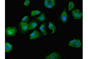 Immunofluorescent analysis of MCF-7 cells using ABIN7149603 at dilution of 1:100 and Alexa Fluor 488-congugated AffiniPure Goat Anti-Rabbit IgG(H+L) (DOCK8 antibody  (AA 1900-2099))