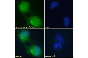 ABIN184938 Immunofluorescence analysis of paraformaldehyde fixed U251 cells, permeabilized with 0. (STRADB antibody  (C-Term))
