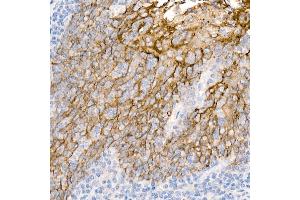 Immunohistochemistry of paraffin-embedded Human tonsil using TROP-2 antibody (ABIN7271103) at dilution of 1:2700 (40x lens). (TACSTD2 antibody)