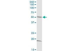 ABI2 MaxPab rabbit polyclonal antibody. (ABI2 antibody  (AA 1-475))