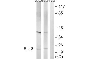 Western blot analysis of extracts from COLO cells and HeLa cells, using RPL18 antibody.