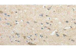 Immunohistochemistry of paraffin-embedded Human brain using SIRT3 Polyclonal Antibody at dilution of 1:30 (SIRT3 antibody)