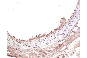 Formalin-fixed and paraffin-embedded rat Carotid artery labeled with Rabbit Anti-IGF-I Polyclonal Antibody , Unconjugated at 1:200 followed by conjugation to the secondary antibody and DAB staining (IGF1 antibody  (AA 49-100))