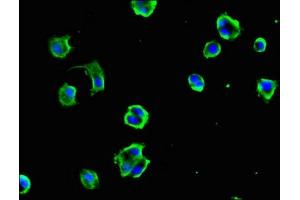 Immunofluorescent analysis of MCF-7 cells using ABIN7149312 at dilution of 1:100 and Alexa Fluor 488-congugated AffiniPure Goat Anti-Rabbit IgG(H+L) (DYNC1H1 antibody  (AA 12-66))