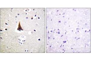 Immunohistochemistry analysis of paraffin-embedded human brain tissue, using VAV2 (Ab-142) Antibody. (VAV2 antibody  (AA 108-157))