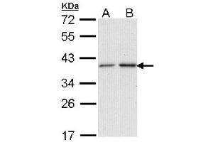 Western Blotting (WB) image for anti-N-Acetyltransferase 2 (Arylamine N-Acetyltransferase) (NAT2) (AA 1-168) antibody (ABIN467624) (NAT2 antibody  (AA 1-168))