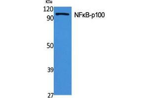 Western Blot (WB) analysis of specific cells using NFkappaB-p100 Polyclonal Antibody. (NFKB2 antibody  (Thr160))