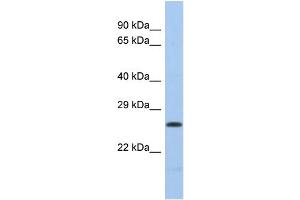 Western Blotting (WB) image for anti-Polymerase (DNA Directed), lambda (POLL) (Middle Region) antibody (ABIN2785954)