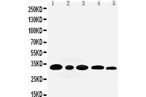 Anti-Aquaporin 3 antibody, Western blotting Lane 1: Rat Kidney Tissue Lysate Lane 2: Rat Lung Tissue Lysate Lane 3: Mouse Kidney Tissue Lysate Lane 4: M453 Cell Lysate Lane 5: MMC Cell Lysate (AQP3 antibody  (C-Term))