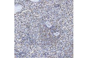 IHC analysis of SF3B3 using anti-SF3B3 antibody (ABIN7602378).