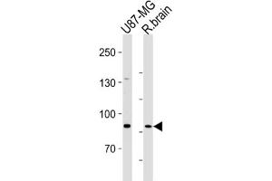 Western Blotting (WB) image for anti-Sema Domain, Transmembrane Domain (TM), and Cytoplasmic Domain, (Semaphorin) 6B (SEMA6B) antibody (ABIN3004602)