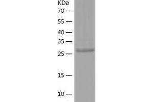 Western Blotting (WB) image for Caspase 1 (CASP1) (AA 120-404) protein (His tag) (ABIN7285894) (Caspase 1 Protein (CASP1) (AA 120-404) (His tag))