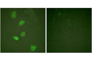 Immunofluorescence analysis of HeLa cells, using HDAC3 (Ab-424) Antibody. (HDAC3 antibody  (AA 379-428))