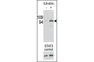 Image no. 1 for anti-Signal Transducer and Activator of Transcription 3 (Acute-Phase Response Factor) (STAT3) (pSer727) antibody (ABIN358233) (STAT3 antibody  (pSer727))