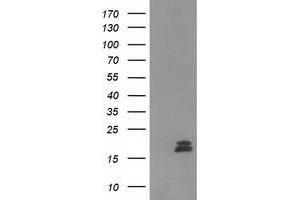 Western Blotting (WB) image for anti-Chromosome 2 Open Reading Frame 40 (C2orf40) antibody (ABIN1497049) (C2orf40 antibody)
