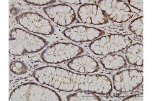 Immunoperoxidase of monoclonal antibody to CIB1 on formalin-fixed paraffin-embedded human colon. (CIB1 antibody  (AA 1-191))
