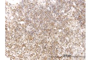Immunoperoxidase of monoclonal antibody to STAT5B on formalin-fixed paraffin-embedded human lymph node. (STAT5B antibody  (AA 678-787))