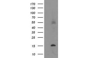 HEK293T cells were transfected with the pCMV6-ENTRY control (Left lane) or pCMV6-ENTRY C20orf30 (Right lane) cDNA for 48 hrs and lysed. (C20orf30 antibody)