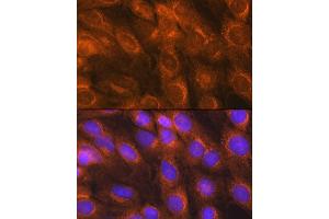 Immunofluorescence analysis of C6 cells using LM Rabbit pAb (ABIN6131613, ABIN6143266, ABIN6143267 and ABIN6214694) at dilution of 1:100 (40x lens). (LMAN1 antibody  (AA 270-480))