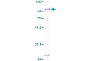 BTD Protein (AA 1-543) (GST tag)