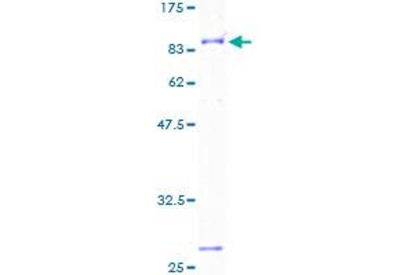 BTD Protein (AA 1-543) (GST tag)