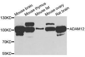Western blot analysis of extracts of various cell lines, using ADAM12 antibody. (ADAM12 antibody  (AA 589-738))