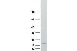 Validation with Western Blot