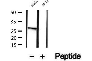 Western blot analysis of extracts of HeLa cells, using RAB12 antibody. (RAB12 antibody  (C-Term))