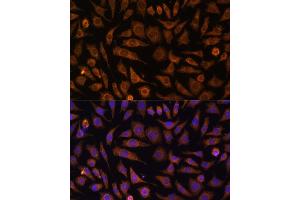 Immunofluorescence analysis of L929 cells using RA antibody (ABIN7269797) at dilution of 1:100. (RAB1A antibody  (AA 1-100))