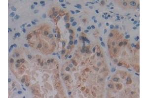 Detection of PKD1 in Human Kidney Tissue using Polyclonal Antibody to Protein Kinase D1 (PKD1) (PKC mu antibody)