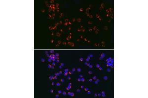 Immunofluorescence analysis of Jurkat cells using TLR6 Rabbit pAb (ABIN7270847) at dilution of 1:150 (40x lens). (TLR6 antibody  (AA 32-200))