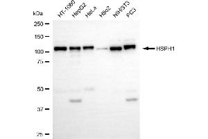 Western blotting analysis using HSPH1 antibody (ABIN7798840).