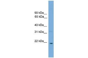 WB Suggested Anti-CTF1 Antibody Titration: 0. (Cardiotrophin 1 antibody  (N-Term))