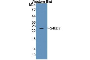 Western blot analysis of the recombinant protein. (PTPRA antibody  (AA 624-800))