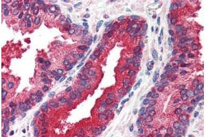 Human Prostate (formalin-fixed, paraffin-embedded) stained with EIF2AK2 antibody ABIN214488 at 2. (EIF2AK2 antibody  (C-Term))
