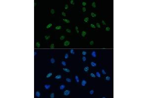 Immunofluorescence analysis of U-2 OS cells using MKL1 Polyclonal Antibody (ABIN6132380, ABIN6143855, ABIN6143858 and ABIN6224589) at dilution of 1:100 (40x lens). (MKL1 antibody  (AA 1-280))