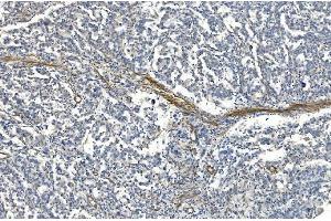 IHC analysis of Filamin A/FLNA using anti-Filamin A/FLNA antibody (ABIN7601783). (Filamin A antibody  (AA 451-638))