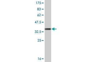 Western Blot detection against Immunogen (36. (CDK5 antibody  (AA 195-292))
