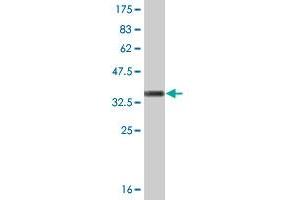 Western Blot detection against Immunogen (36. (CDK5 antibody  (AA 195-292))